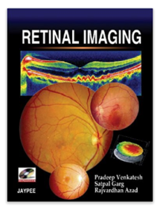Retinal Imaging With Photo Dvd-Rom Hardcover – 2008 at Rs.94